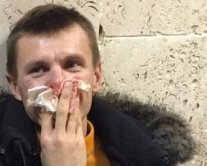 Чому затримали Кобу: версії