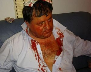 У Раді БЮТівця побили до крові