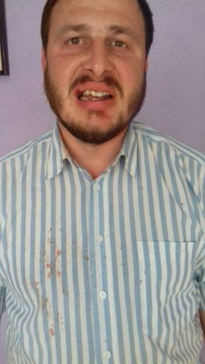 Священник УПЦ МП побил священника епархии Киевского патриархата Фото 1 Священник УПЦ МП побил священника епархии Киевского патриархата Фото 1