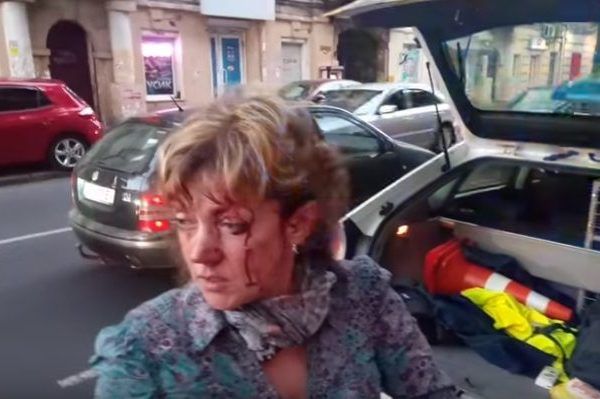 У центрі Одеси побили відому активістку Подолянку