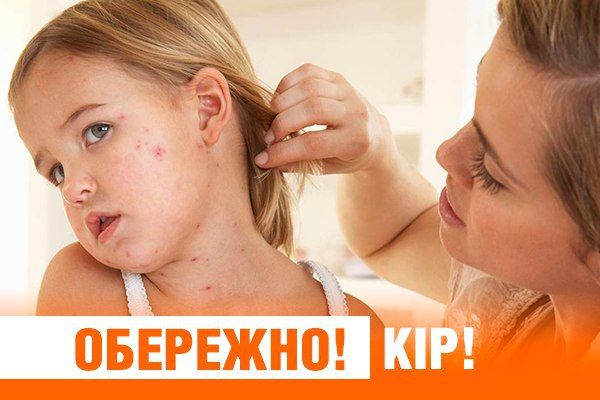 Вспышка кори в школе Луцка