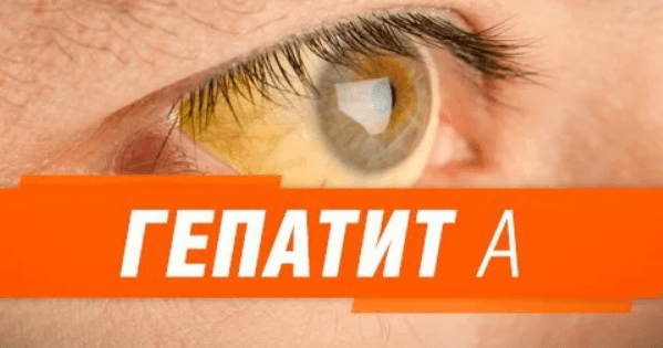 Гепатит А в Николаеве – госпитализированы 44 человека