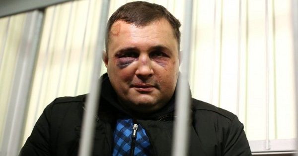Суд на Шепелевым: СБУ ответила на сломанную челюсть и похищение