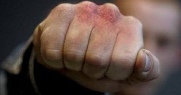У Чернігові чоловік побився з поліцейським і помер драка