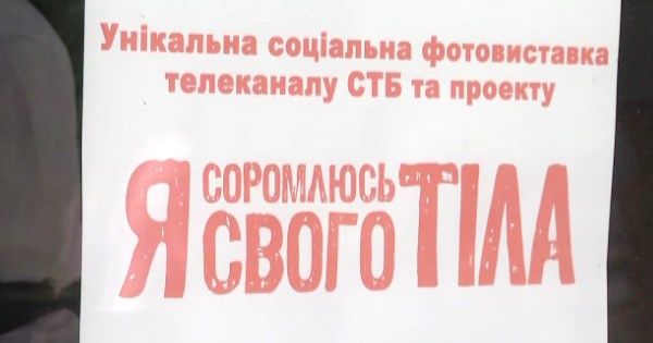 21 история победы над болезнью и стыдом: фотовыставка Я соромлюся свого тіла