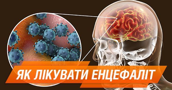 Что такое энцефалит и как его лечить Енцефаліт