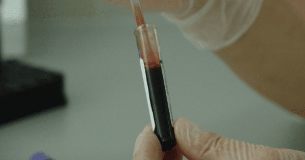 Випробування вакцини проти ВІЛ – результати вражають Ліки від СНІДу