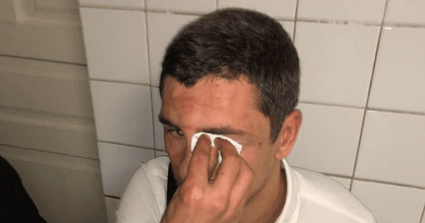 Зламали ніс та щелепу: в Києві побили голову