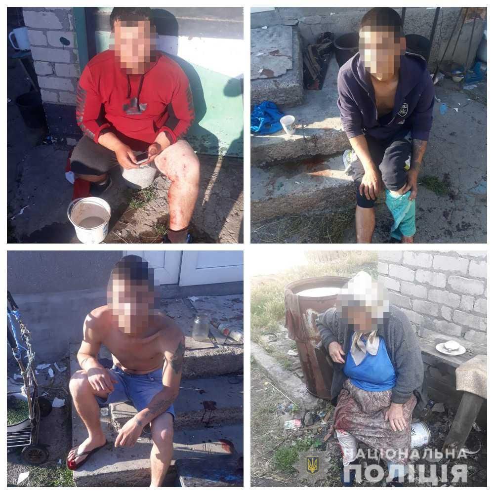 Принесли домой и разобрали: в Одесской области от взрыва гранаты пострадали пять человек Взрыв гранаты в Одесской области: есть пострадавшие