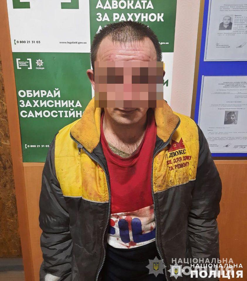 В Николаеве мужчина облил химвеществом всю семью, пострадала годовалая девочка Поліція Миколаївська область