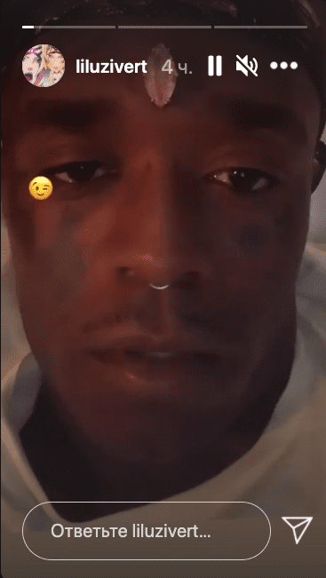 Lil Uzi Vert имплантировал бриллиант в лоб (ФОТО)