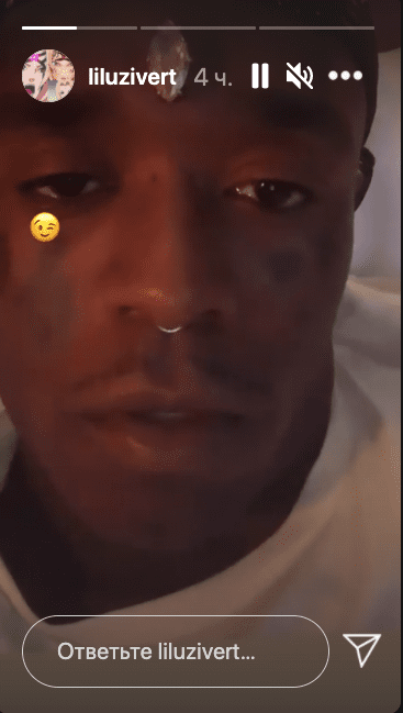 Lil Uzi Vert имплантировал бриллиант в лоб (ФОТО)