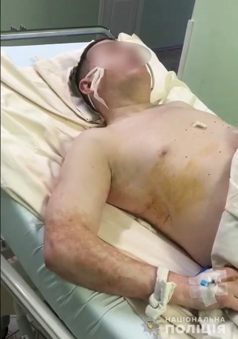 Під Києвом розшукують чоловіка, який розстріляв знайомого з автомата Фото 2 Біла церква НП – розшукують чоловіка, який розстріляв знайомого з автомата Фото 2
