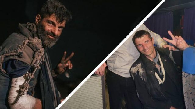 Доказательство “гуманности” врага: в руке освобожденного из плена Дианова не хватает 4 см кости