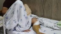 Постраждалі від обстрілу Одеси 23 липня 2023