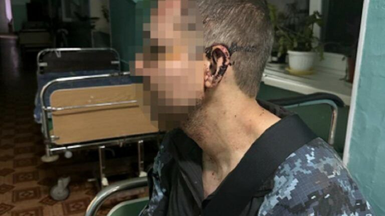 Численні забої голови: на Одещині у військовій частині побили солдата