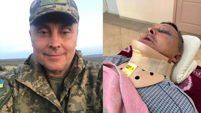 Юрій Купріч – помер військовий, якого побили в Чорноморську Одеської області