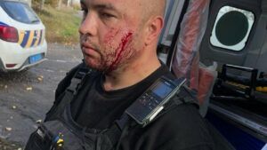 Завдав удару по обличчю: у Павлограді чоловік із ножем напав на поліцейських