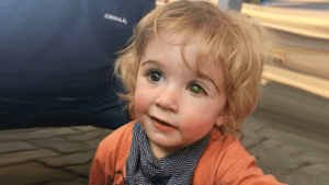 осліп після поцілунку з герпесом