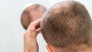 відновлення волосся