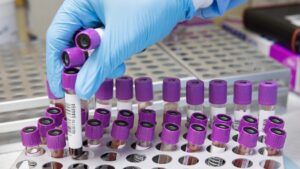 потепління загрожує смертоносним грибком