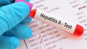 спалах гепатиту А в Києві