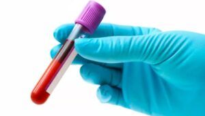 універсальна група крові