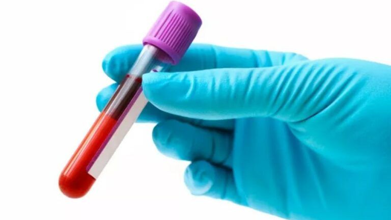 універсальна група крові