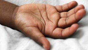 шкіра препарат США