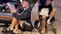 Анатолій Анатоліч зламав пальці на нозі