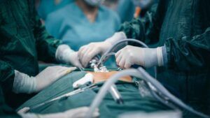 лапароскопія