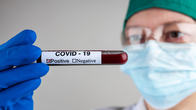 Коронавірус у Херсонській області: на Covid-19 тестуватимуть персонал баз відпочинку