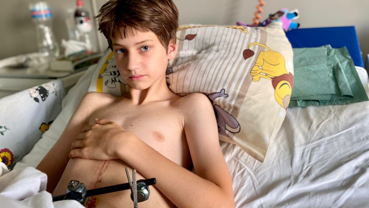 В Охматдиті врятували 13-річного велосипедиста, який отримав у ДТП важкі каліцтва