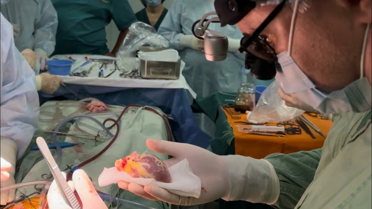 пересадка серця