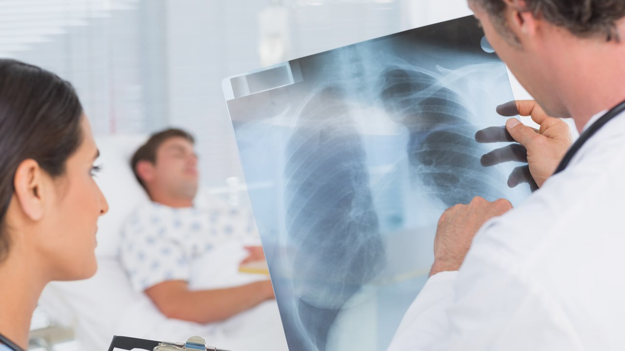 рентгенівський знімок легень