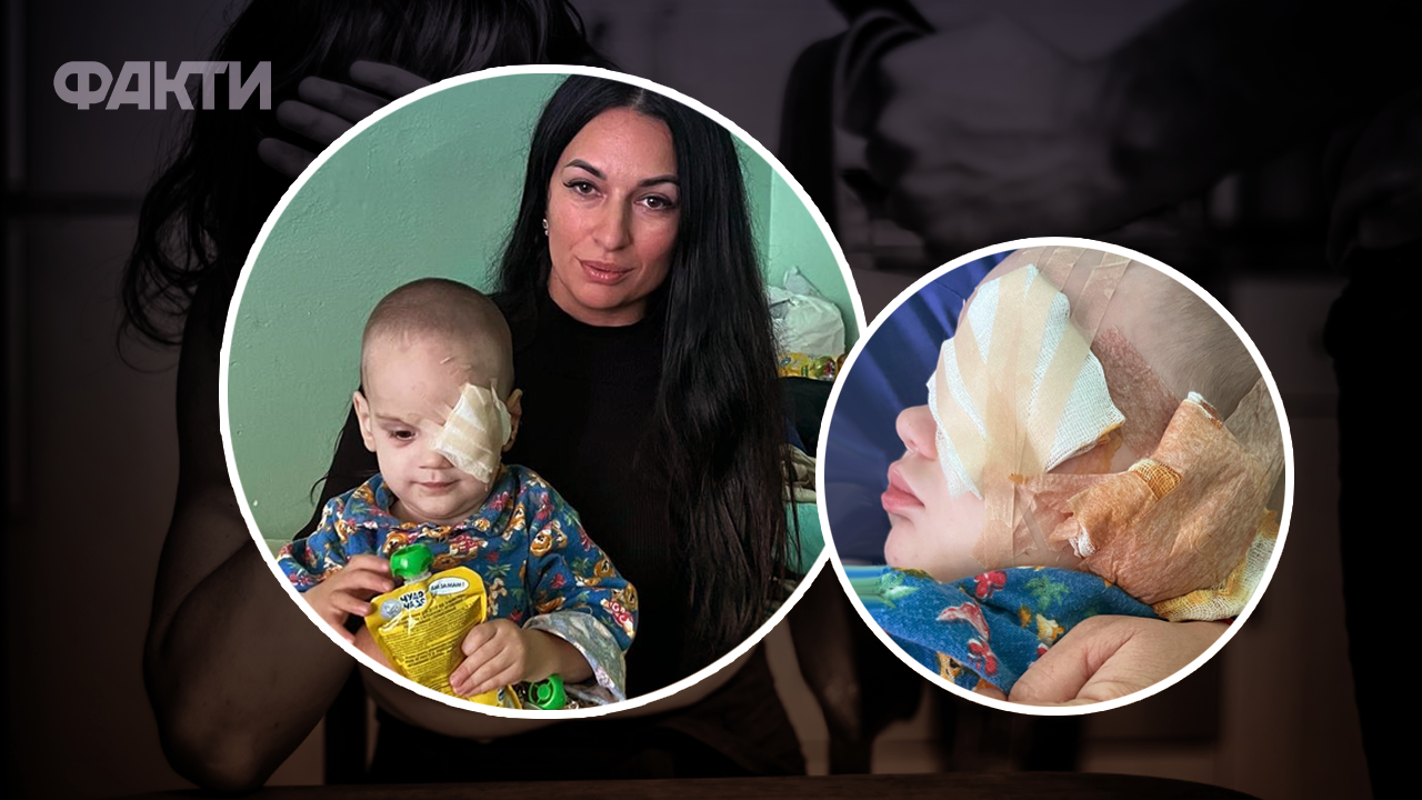 дитині розірвали вушко