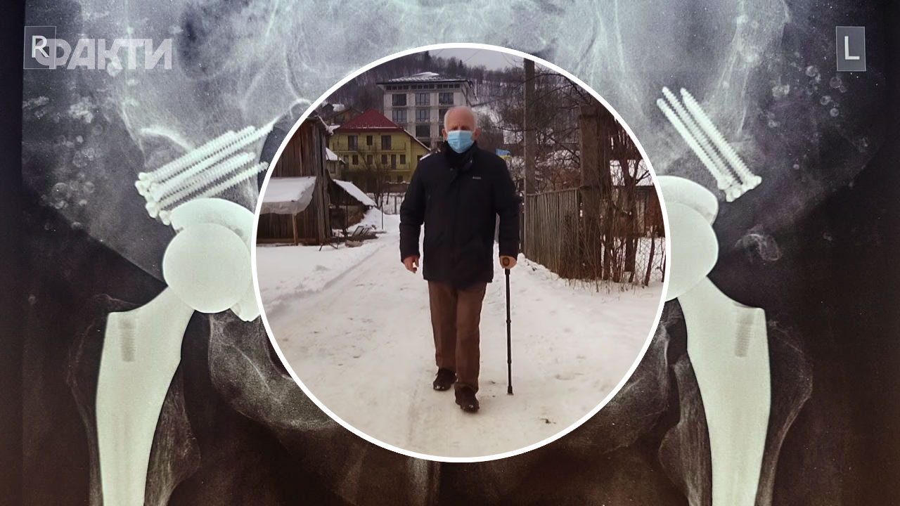 дідусь з ендопротезами кульшових суглобів