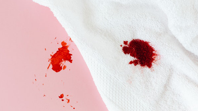 Как убрать засохшую кровь с одежды – лучшие способы