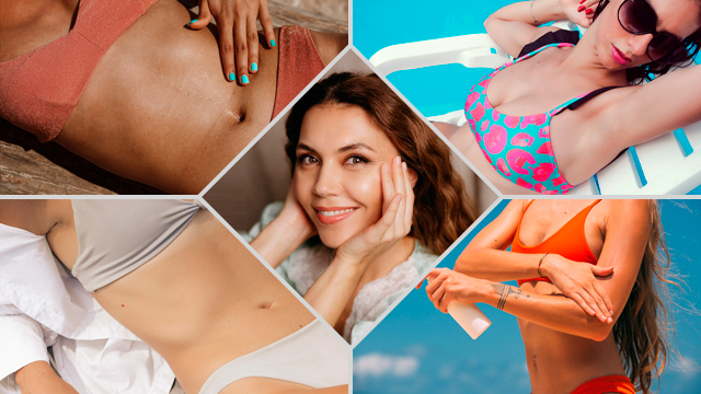 Модные купальники 2022: на какие модели стоит обратить внимание этим летом — ФОТО